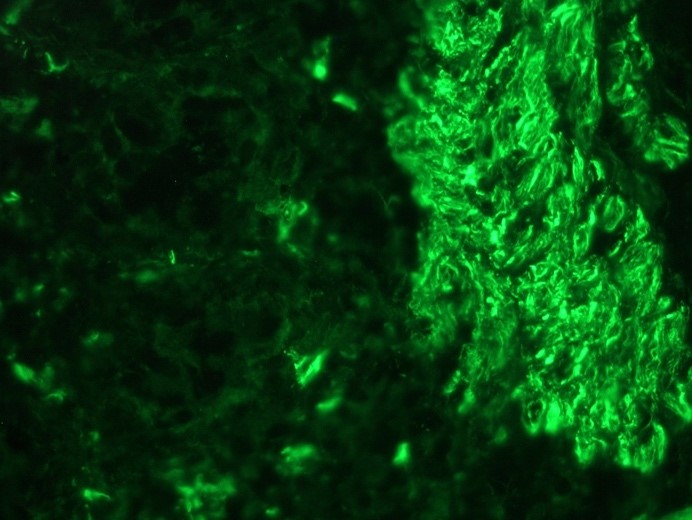 Figure 1. Muscle cell immunostaining in frozen section of swine colon for desmin using MUB0402S (K5; diluted 1:100).